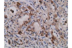 Immunohistochemical staining of paraffin-embedded Human liver tissue using anti-SDR9C7 mouse monoclonal antibody. (SDR9C7 抗体)