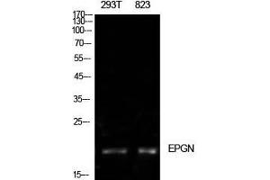Western Blot (WB) analysis of 293T, 823 cells using Epigen Polyclonal Antibody. (Epigen 抗体  (Internal Region))
