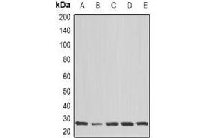 Western blot analysis of COX2 expression in Hela (A), MCF7 (B), Jurkat (C), mouse brain (D), rat brain (E) whole cell lysates. (COX2 抗体)