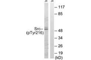 Western blot analysis of extracts from Jurkat cells treated with EGF 200ng/ml 5', using Src (Phospho-Tyr216) Antibody. (Src 抗体  (pTyr216))