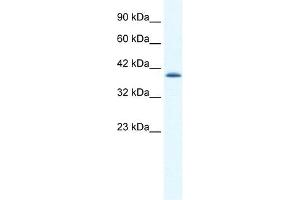 CATSPER2 antibody used at 1. (CATSPER2 抗体  (N-Term))