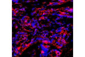 Immunofluorescence of paraffin embedded mouse colon using Annexin-A4 (ABIN7073066) at dilution of 1: 1800 (400x lens) (Annexin IV 抗体)