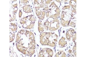 Immunohistochemistry of paraffin-embedded Human stomach using OPRK1 Polyclonal Antibody at dilution of 1:100 (40x lens). (OPRK1 抗体)