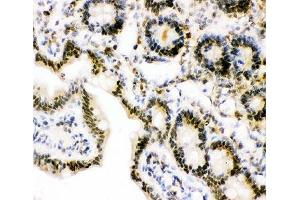 IHC-P: Ubiquitin antibody testing of rat intestine tissue