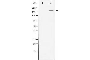 Western blot analysis of WNK1 expression in EGF treated 293 whole cell lysates,The lane on the left is treated with the antigen-specific peptide. (WNK1 抗体  (N-Term))