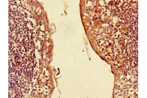 Immunohistochemistry of paraffin-embedded human tonsil tissue using ABIN7146133 at dilution of 1:100 (CXCL3 抗体  (AA 35-107))