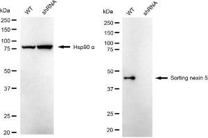 Western blotting analysis using Sorting nexin 5 antibody (ABIN7800410).