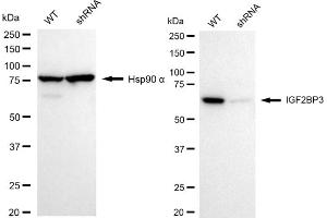 Western blotting analysis using IGF2BP3 antibody (ABIN7799052). (Recombinant IGF2BP3 抗体)