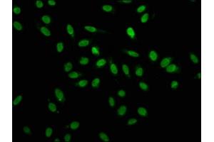 Immunofluorescence staining of Hela cells with ABIN7155098 at 1:100, counter-stained with DAPI. (HNRNPA1 抗体  (AA 2-354))