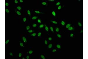 Immunofluorescence staining of Hela cells with ABIN7155098 at 1:100, counter-stained with DAPI. (HNRNPA1 抗体  (AA 2-354))
