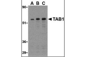 Western Blotting (WB) image for anti-TGF-beta Activated Kinase 1/MAP3K7 Binding Protein 1 (TAB1) (Middle Region) antibody (ABIN1031115)