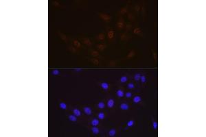 Immunofluorescence (IF) image for anti-RAD23 Homolog A (RAD23A) antibody (ABIN7269824)
