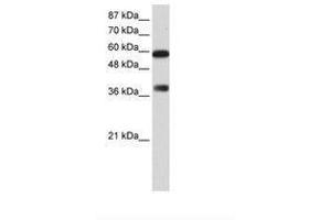 Image no. 1 for anti-AT Rich Interactive Domain 3B (BRIGHT-Like) (ARID3B) (C-Term) antibody (ABIN6736169) (ARID3B 抗体  (C-Term))