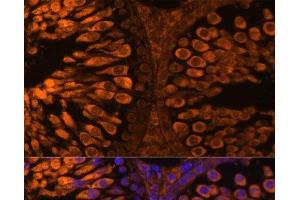 Immunofluorescence analysis of Rat testis using LDHC Polyclonal Antibody at dilution of 1:100 (40x lens). (Lactate Dehydrogenase C 抗体)
