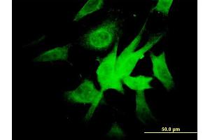 Immunofluorescence of monoclonal antibody to NDUFA9 on NIH/3T3 cell. (NDUFA9 抗体  (AA 303-377))