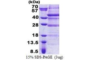 Retinoic Acid Induced 12 (RAI12) (AA 1-316) protein (His tag)