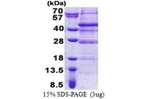 SDS-PAGE (SDS) image for Retinoic Acid Induced 12 (RAI12) (AA 1-316) protein (His tag) (ABIN5853172) (Retinoic Acid Induced 12 (RAI12) (AA 1-316) protein (His tag))