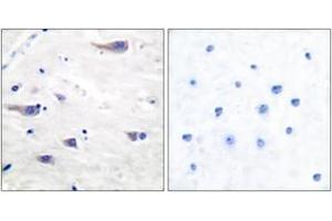 Immunohistochemistry (IHC) image for anti-Platelet Derived Growth Factor Receptor beta (PDGFRB) (AA 718-767) antibody (ABIN2889053) (PDGFRB 抗体  (AA 718-767))