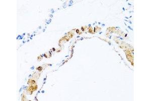 Immunohistochemistry of paraffin-embedded Rat lung using PHPT1 Polyclonal Antibody at dilution of 1:100 (40x lens). (PHPT1 抗体)