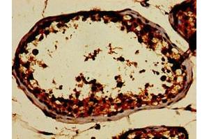 Immunohistochemistry of paraffin-embedded human testis tissue using ABIN7162483 at dilution of 1:100 (SIN3A 抗体  (AA 1-123))
