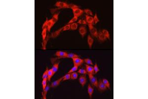 Immunofluorescence analysis of PC-12 cells using S6 Ribosomal Protein (RPS6) Rabbit pAb (ABIN6133901, ABIN6147227, ABIN6147228 and ABIN6221687) at dilution of 1:100 (40x lens). (RPS6 抗体  (AA 1-100))