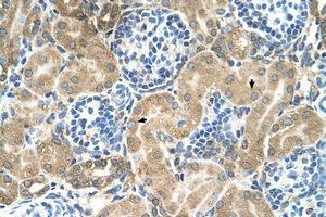 Image no. 1 for anti-Transmembrane 9 Superfamily Member 1 (TM9SF1) (AA 31-80) antibody (ABIN205055) (TM9SF1 抗体  (AA 31-80))