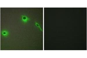Immunofluorescence analysis of A549 cells, using Collagen XVIII alpha1 Antibody. (COL18A1 抗体  (AA 801-850))