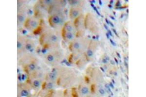 Used in DAB staining on fromalin fixed paraffin-embedded Liver tissue (Insulin Receptor 抗体  (AA 1027-1364))