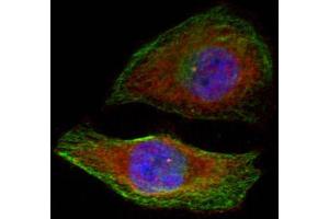 Immunofluorescence staining of methanol-fixed Hela cells showing cytoplasmic, nuclear staining using Phospho-MAPK3-T202 antibody.