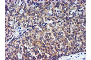 Image no. 4 for anti-Metalloproteinase Inhibitor 2 (TIMP2) antibody (ABIN1501394) (TIMP2 抗体)