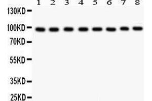 Anti- TFRC antibody, Western blotting All lanes: Anti TRFC  at 0. (Transferrin Receptor 抗体  (AA 1-198))
