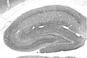 Adult rat hippocampus immunohistochemistry. (DLX1 抗体  (AA 53-74))