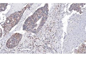 Immunohistochemistry (IHC) image for anti-AT Rich Interactive Domain 3A (BRIGHT-Like) (ARID3A) (Internal Region) antibody (ABIN2856170)