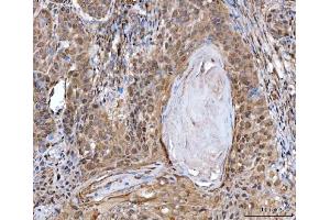IHC analysis of MRE11 using anti-MRE11 antibody (ABIN7601056).