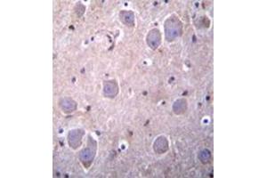 Formalin fixed, paraffin embedded human brain tissue stained with RAP1GDS1 Antibody  followed by peroxidase conjugation of the secondary antibody and DAB staining. (RAP1GDS1 抗体  (Middle Region))