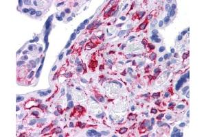 STAT5B antibody was used for immunohistochemistry at a concentration of 4-8 ug/ml. (STAT5B 抗体  (N-Term))