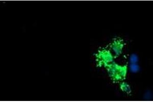 Anti-LCMT1 mouse monoclonal antibody (ABIN2454745) immunofluorescent staining of COS7 cells transiently transfected by pCMV6-ENTRY LCMT1 (RC200018). (LCMT1 抗体)