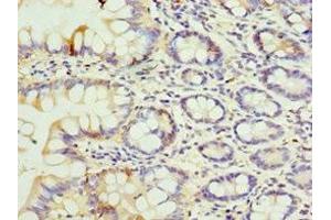 Immunohistochemistry of paraffin-embedded human small intestine tissue using ABIN7152051 at dilution of 1:100 (SULT1E1 抗体  (AA 140-294))
