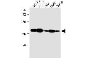 All lanes : Anti-ADA Antibody (C-term) at 1:1000 dilution Lane 1: MOLT-4 whole cell lysate Lane 2: Jurkat whole cell lysate Lane 3: Hela whole cell lysate Lane 4: HL-60 whole cell lysate Lane 5: D whole cell lysate Lysates/proteins at 20 μg per lane. (ADA 抗体  (C-Term))