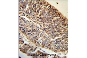 Immunohistochemistry (Paraffin-embedded Sections) (IHC (p)) image for anti-Paired-Like Homeodomain 1 (PITX1) (AA 123-150) antibody (ABIN391506)