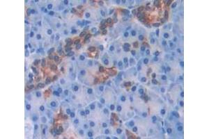 IHC-P analysis of Human Tissue, with DAB staining. (CXCL2 抗体  (AA 34-107))