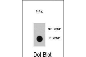 Dot blot analysis of anti-RAF1 Phospho-specific Pab (ABIN389895 and ABIN2839736) on nitrocellulose membrane. (RAF1 抗体  (pSer339))
