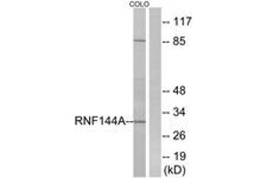 Western blot analysis of extracts from COLO cells, using RNF144A Antibody. (RNF144A 抗体  (AA 151-200))