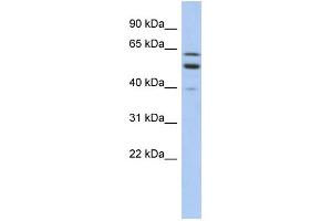 WB Suggested Anti-TMCC1 Antibody Titration:  0. (TMCC1 抗体  (Middle Region))