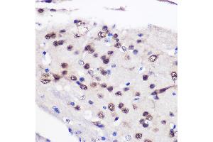 Immunohistochemistry of paraffin-embedded Mouse brain using CELF1 Rabbit pAb (ABIN6131012, ABIN6138399, ABIN6138400 and ABIN6221641) at dilution of 1:100 (40x lens).