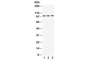 Western blot testing of human 1) HeLa, 2) MCF7 and 3) SMMC cell lysate with RASGAP antibody. (RASA1 抗体)
