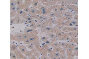 Used in DAB staining on fromalin fixed paraffin- embedded Kidney tissue (CES1 抗体  (AA 18-299))