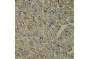 Immunohistochemistry of paraffin-embedded mouse heart using CCBL1 antibody at dilution of 1:100 (x40 lens). (CCBL1 抗体)