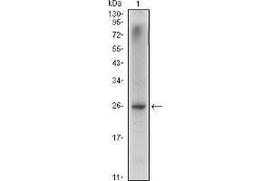 Western blot analysis using NKX3A mouse mAb against LNCaP (1) cell lysate. (NKX3-1 抗体)