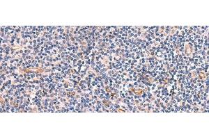 Immunohistochemistry of paraffin-embedded Human tonsil tissue using INSM2 Polyclonal Antibody at dilution of 1:35(x200) (INSM2 抗体)